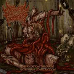 Homophobic Fecalpheliac : Suffocation Through Intestinal Constriction